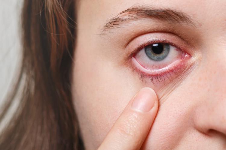 Mata Merah: Sinyal Tersembunyi Kebocoran Pembuluh Darah dan Tumor - Perjalanan Menuju Kesembuhan