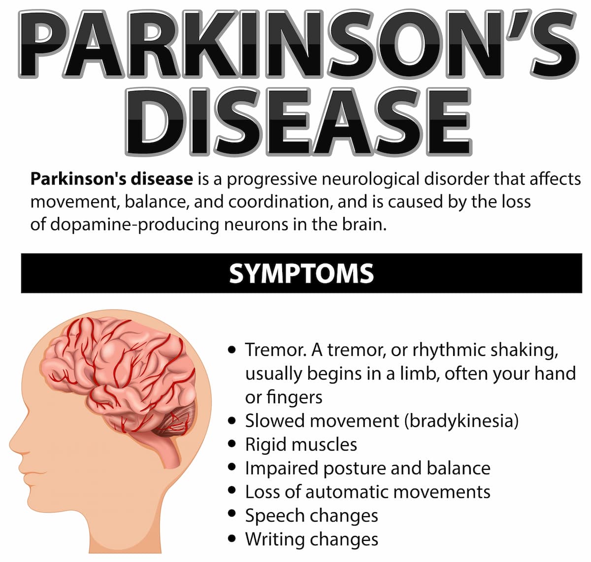 infografis gejala gejala Parkinson